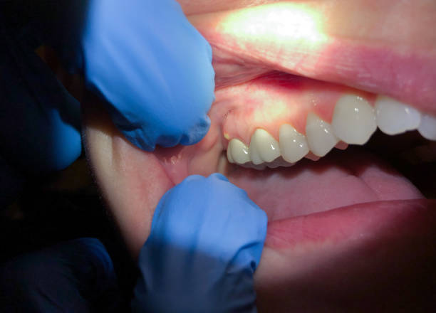 Best Pediatric Emergency Dentist in Valley City, ND