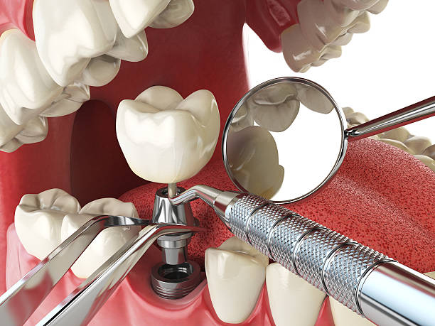 Best Emergency TMJ Treatment in Valley City, ND